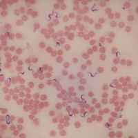 Trypanosoma rhodesiense, Smear Microscope Slide