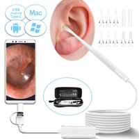 USB Otoscope, 3.9mm Ultra-Thin Digital Otoscope Camera, 720P Ear Inspection Endoscope Visual Ear Scope Cleaner with Ear Wax Remover Cleaning Tool and 6 Adjustable LED Light for Android, Windows, Mac