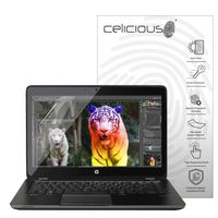 Celicious Matte Anti-Glare Screen Protector Film Compatible with HP ZBook 14 G2 (Non-Touch) [Pack of 2]