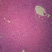 Human Liver, sec. 7 m H&E Microscope Slide