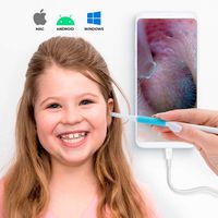 Digital Otoscope & HD Ear Camera with Ear Wax Removal Kit - Ultra Slim Ear Endoscope for Your Utter Safety & Comfort - Our Upgraded Ear Scope Wax Cleaner is Great for Adults, Children & Animals