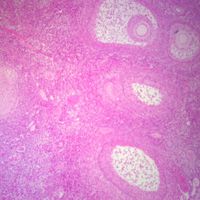 Mammal Ovary Slide, Thin sec, H&E