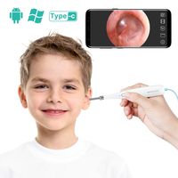 DEPSTECH USB Ear Inspection Otoscope Camera for Ear Health Checking 6 Adjustable LED, Digital Otoscope for OTG Android Devices, Windows & Mac PC
