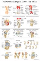 Laminated Anatomy and Injuries of The Knee Poster - Knee Joint Anatomical Chart - 18" x 27"