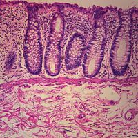 Human Colon Slide, c.s, 7 m, H&E