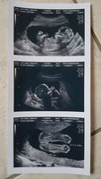 Prank 2D Customized Ultrasound Strip of 3 Photos