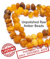 RAW Baltic Amber Necklace - UNPOLISHED Organic Raw Amber Beads - Raw Amber  Necklace Boost Immune System - Pain Relief Properties - GIA Certified Amber Jewelry - Handcrafted